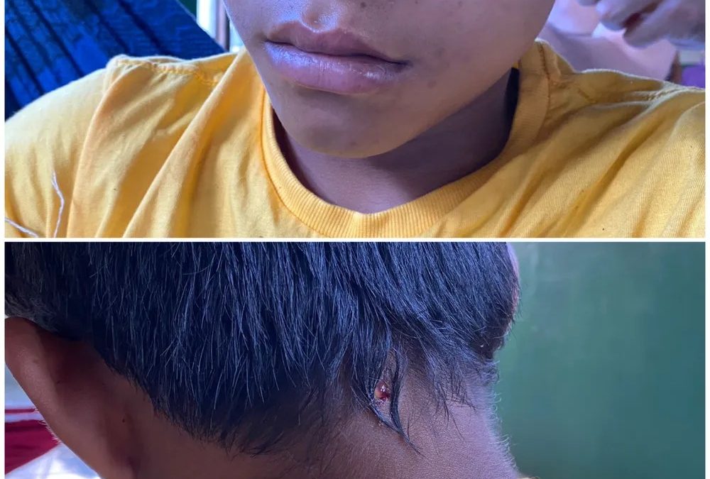 CIMI: Em novo ataque, garimpeiros matam liderança e deixam adolescente ferido na TI Yanomami (RR)