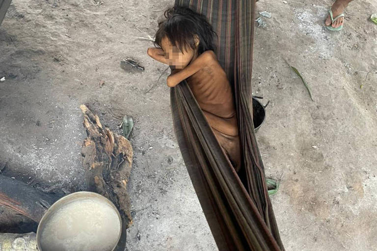 FOLHA: Terra Yanomami fica com auxílio médico limitado por atraso de pagamentos do Ministério da Saúde