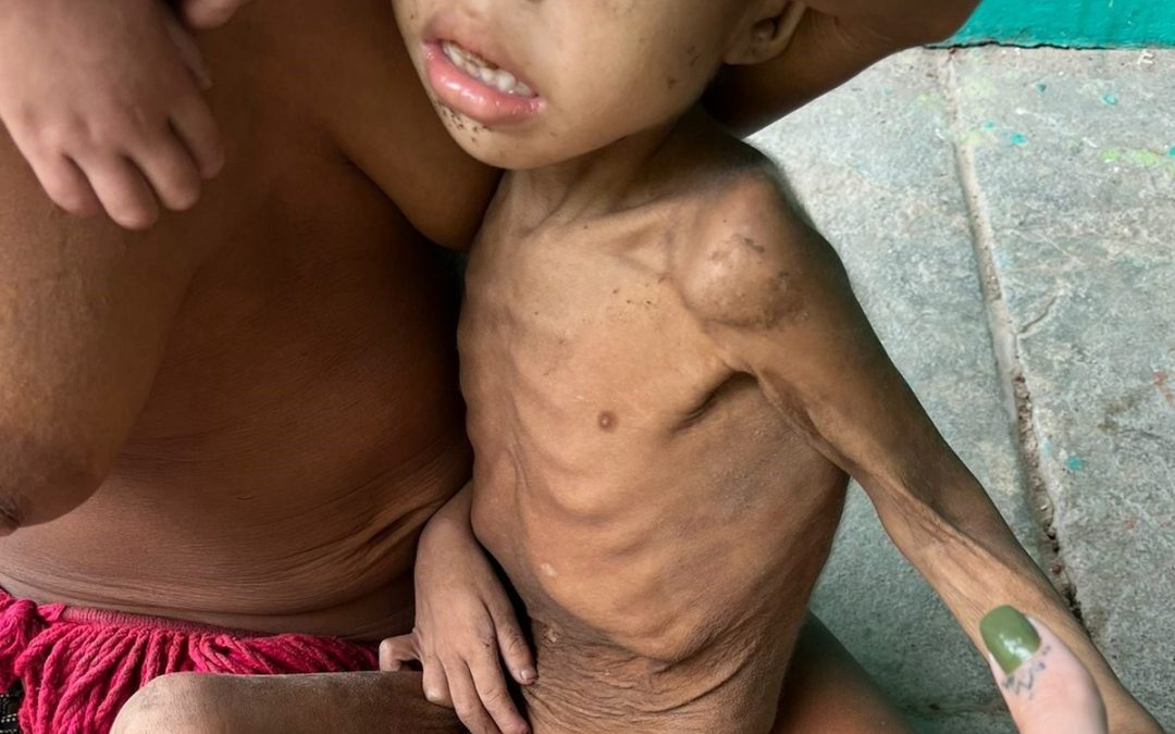 AMAZÔNIA REAL: Crianças Yanomami foram as maiores vítimas