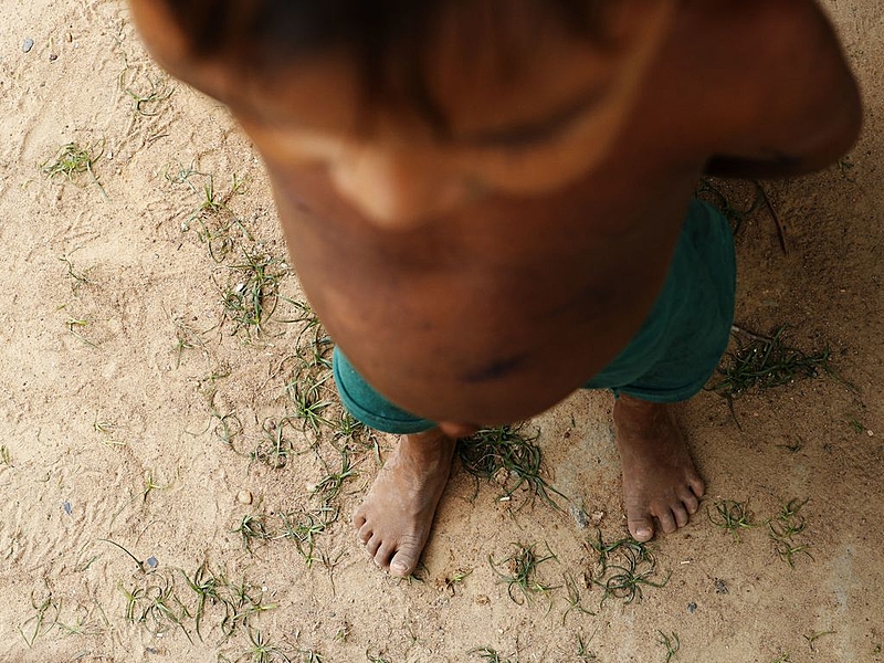 BRASIL DE FATO: Crise humanitária causa nova morte de criança Yanomami por desnutrição
